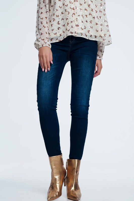 Q2 Gold side detail jeans